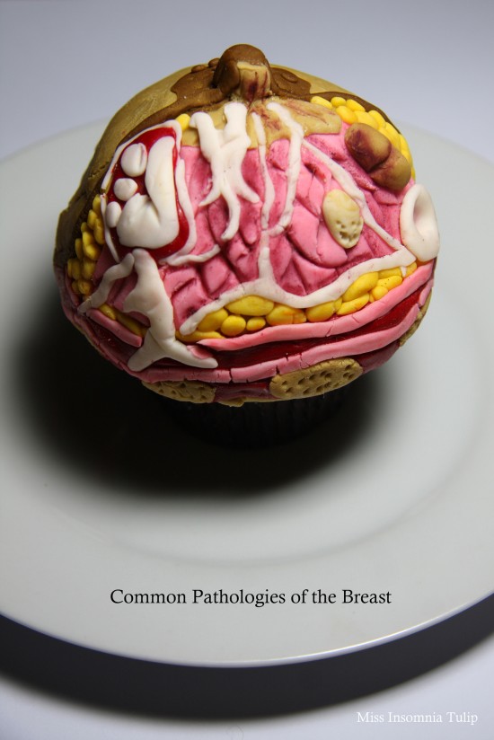Common Pathologies of the Breast