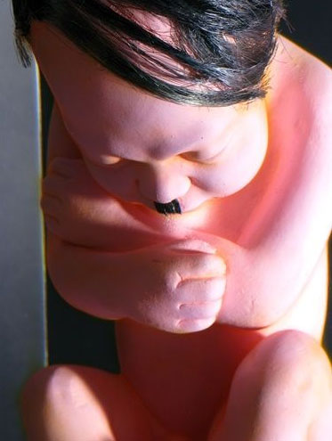 Fetal Hitler
